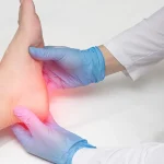 shockwave treatment